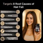 Smiling woman holding Probless Biotin bottle, infographic showing 8 root causes of hair fall including nutritional deficiency, stress, DHT hormone levels, thyroid imbalance, scalp health, chemical treatments, crash dieting, and autoimmune disorder.